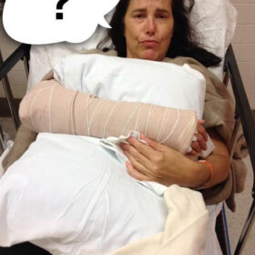 pams broken arm caption contest